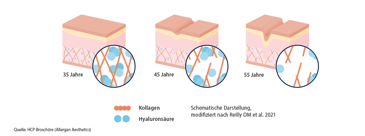 harmonyca allergan wirkungsweise