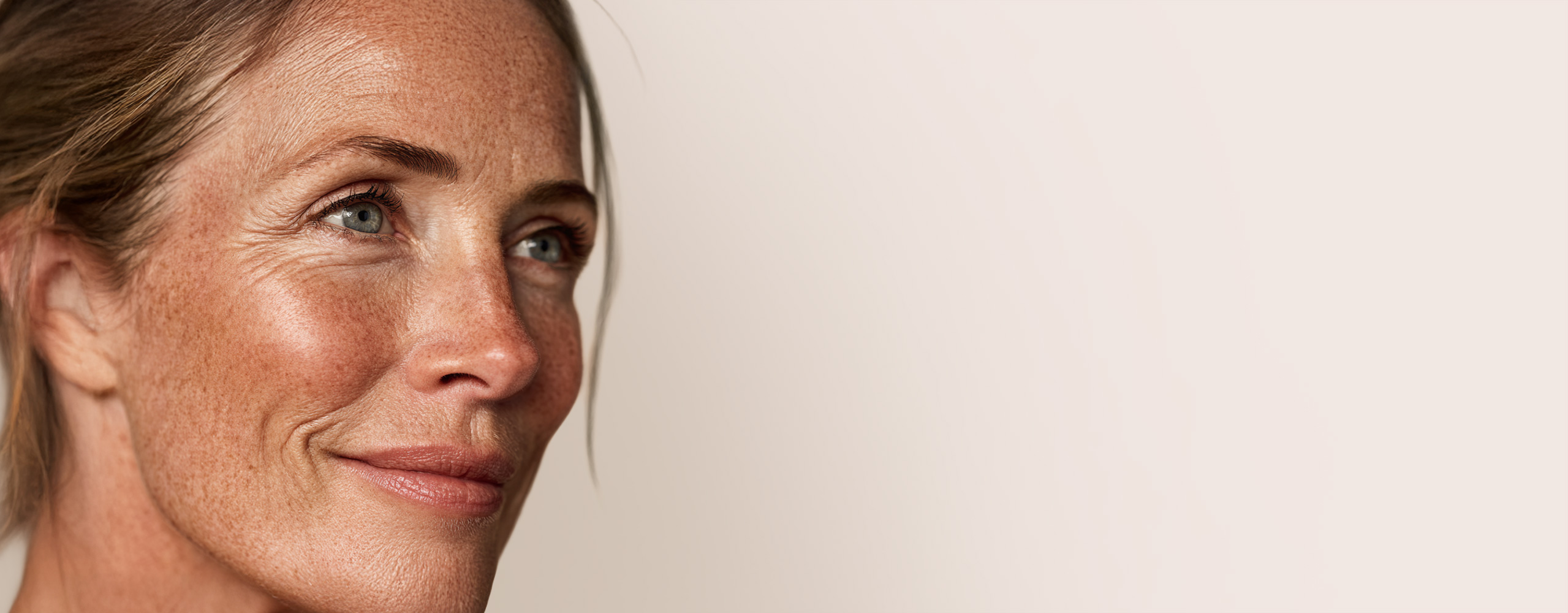 brow lift proaesthetic